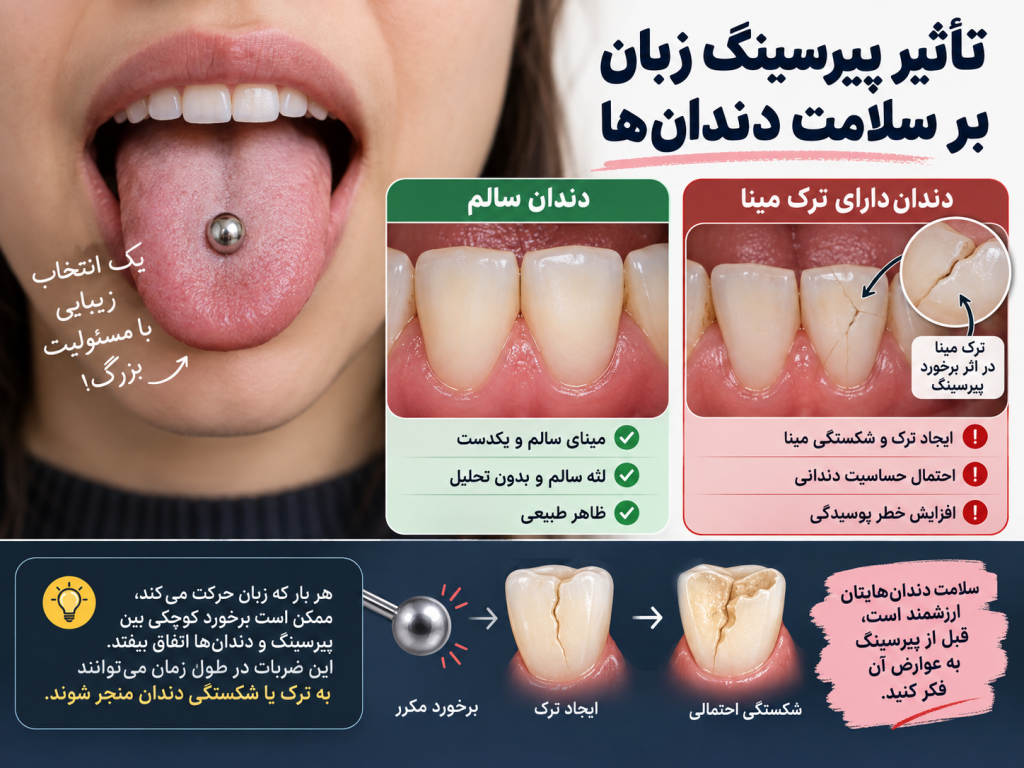 نمایش نقطه برخورد باربل پیرسینگ زبان با سطح داخلی دندان‌های جلوی فک پایین