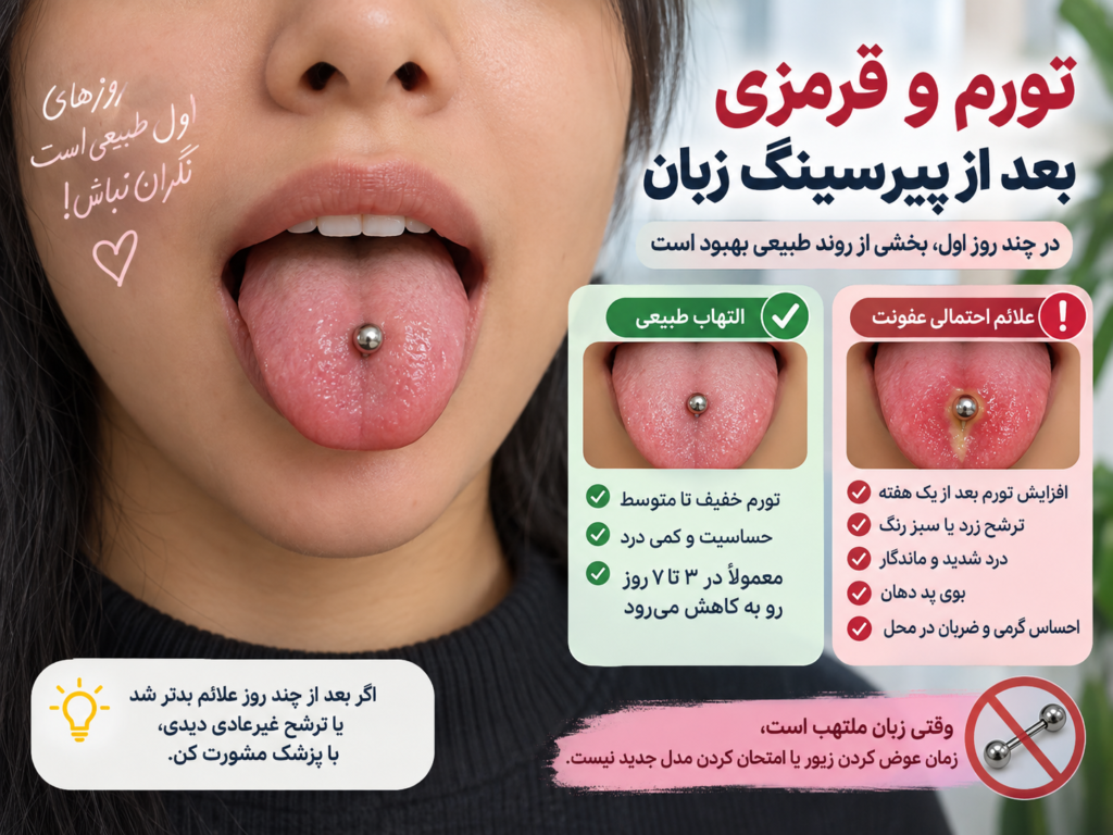 تورم و قرمزی اطراف پیرسینگ زبان در روزهای اول