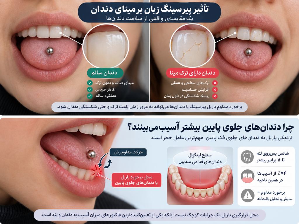 علائم اولیه آسیب دندان و لثه ناشی از پیرسینگ زبان که باید جدی گرفته شوند