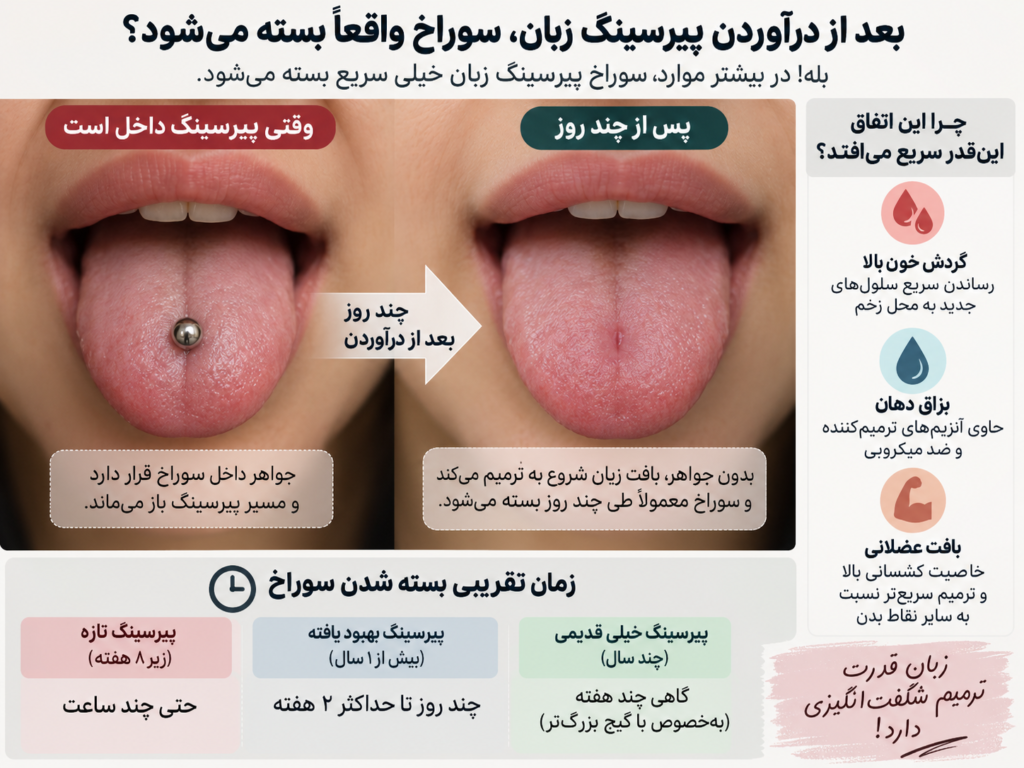 نمای نزدیک از جای زخم کوچک روی زبان بعد از سال‌ها پیرسینگ