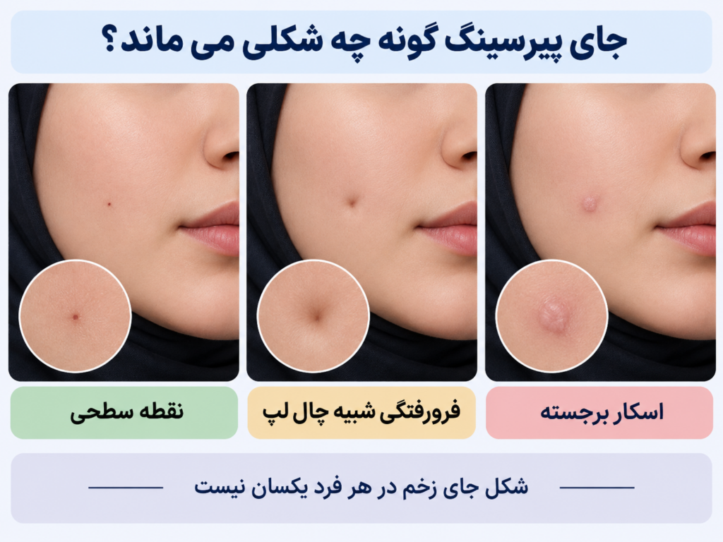 مقایسه انواع جای پیرسینگ گونه شامل نقطه سطحی، فرورفتگی شبیه چال لپ و اسکار برجسته