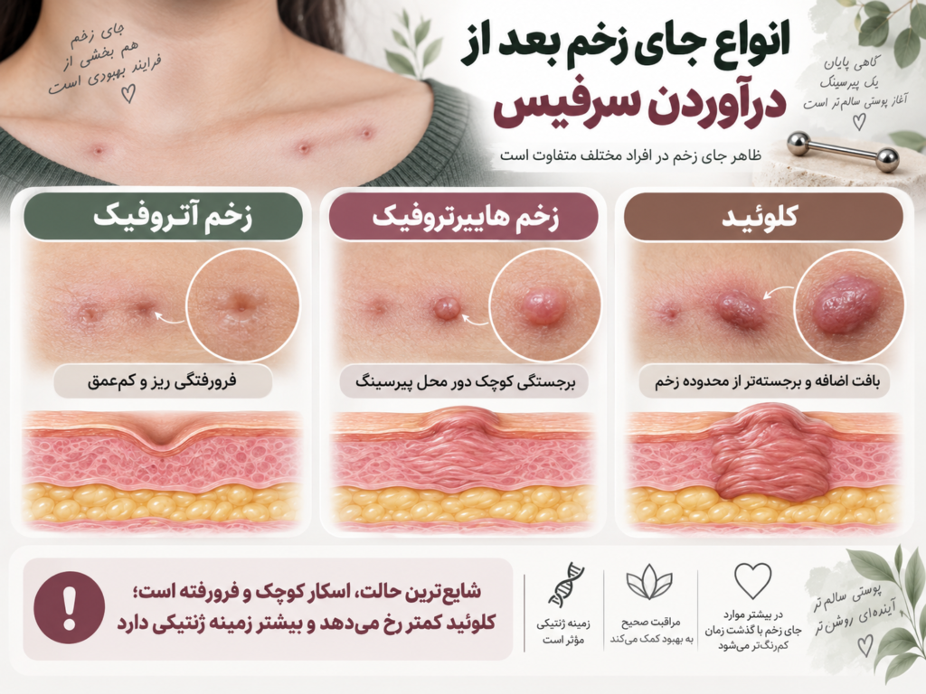 سه نوع مختلف جای زخم پیرسینگ شامل زخم آتروفیک فرورفته، زخم هایپرتروفیک برجسته و زخم کلوئید
