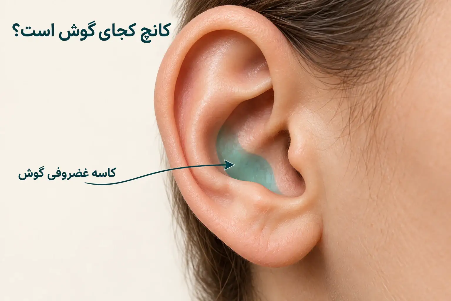محل کانچ در کاسه غضروفی وسط لاله گوش کنار ورودی مجرای شنوایی
