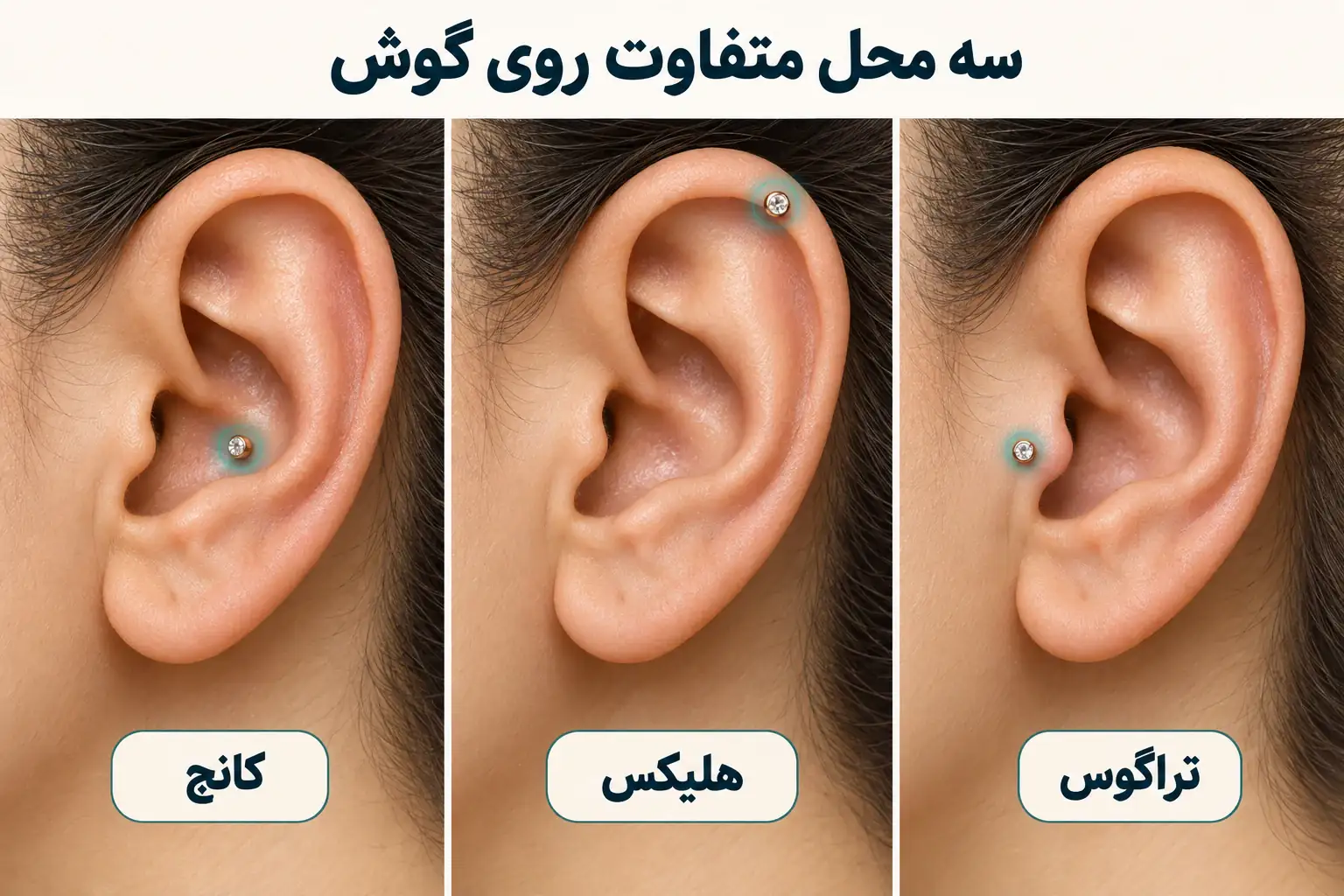 مقایسه کانچ در کاسه گوش با هلیکس روی لبه و تراگوس جلوی مجرای شنوایی
