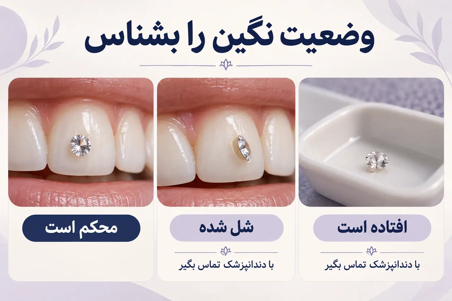 اینفوگرافیک نگین محکم، نگین شل شده و نگین افتاده