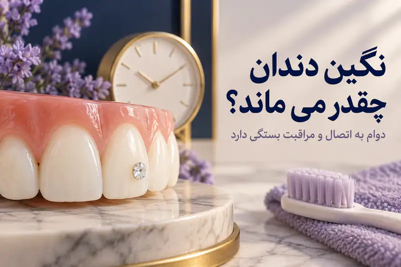 تصویر شاخص متن دار ماندگاری نگین دندان با ساعت و دندان نگین دار