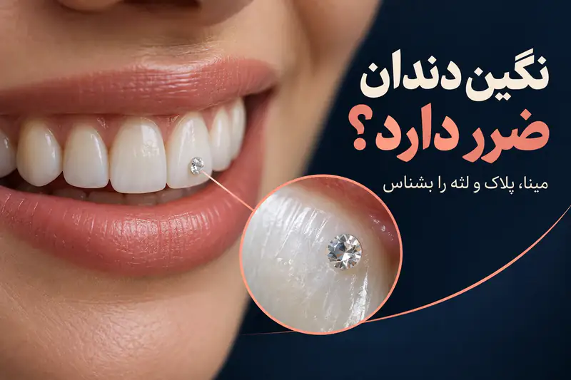 تصویر شاخص متن دار عوارض نگین دندان و بررسی مینا و پلاک