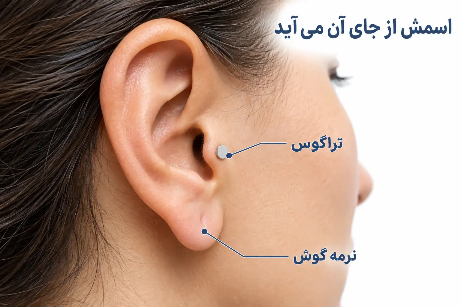 نمای آموزشی محل تراگوس جلوی مجرای گوش و تفاوت آن با نرمه گوش